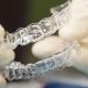 invisalign - aparat ortodontyczny - invisalign niewidoczny aparat